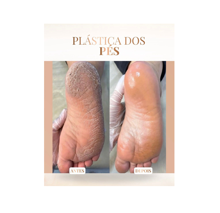Clínica Joanna Mattos – Plástica dos Pés